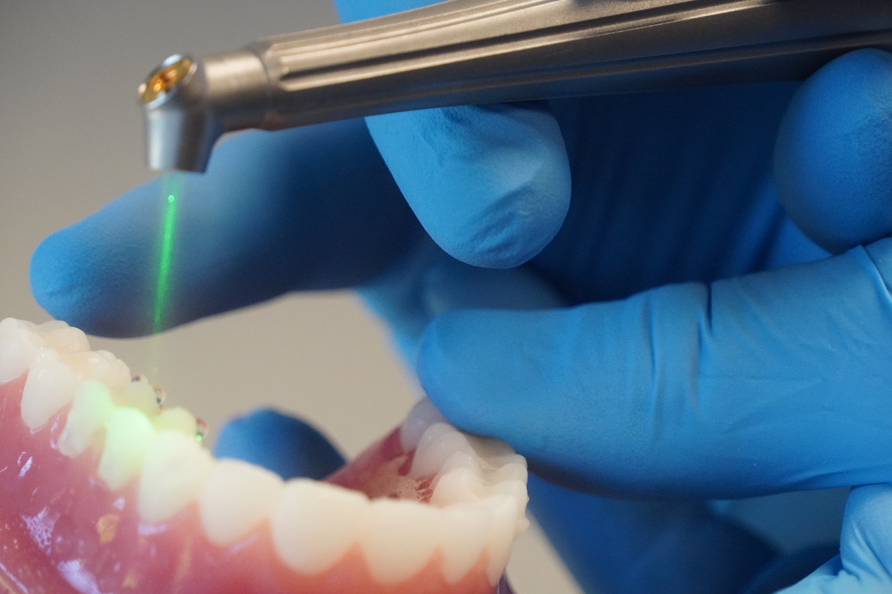 Laser Dentistry